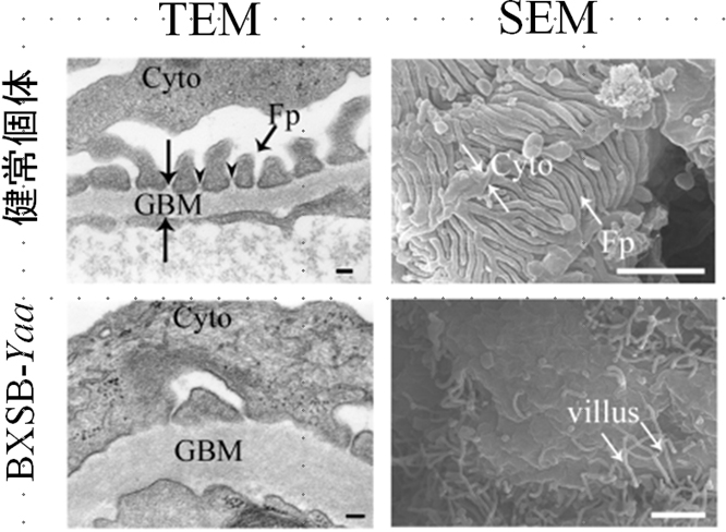 足細胞の透過型（TEM）および走査型（SEM）電子顕微鏡像