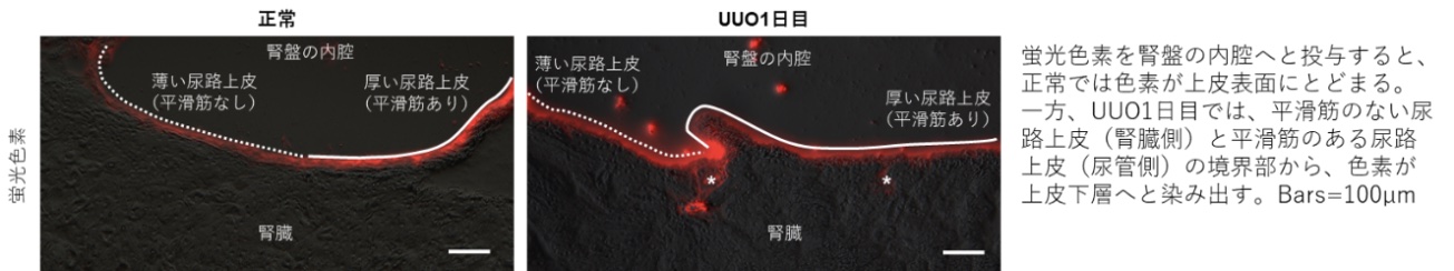 蛍光色素を腎盤の内腔に投与すると尿路上皮バリアの破綻部位から上皮下層に色素が滲出した。