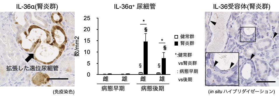 障害された遠位尿細管で発現誘導されるIL-36αとその受容体